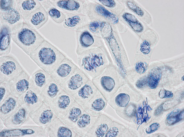 cells-in-mitosis